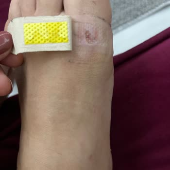 Kısa Sürede Deforme Olan Ayakkabı Ve Olumsuz Müşteri Hizmeti