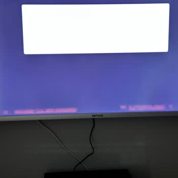 Sıfır Televizyonumun Arızası Çözülmüyor, Servis Mağduriyetimi Artırıyor