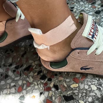 Aldığım Ayakkabı Ayağımı Yaraladı, İade Talep Ediyorum