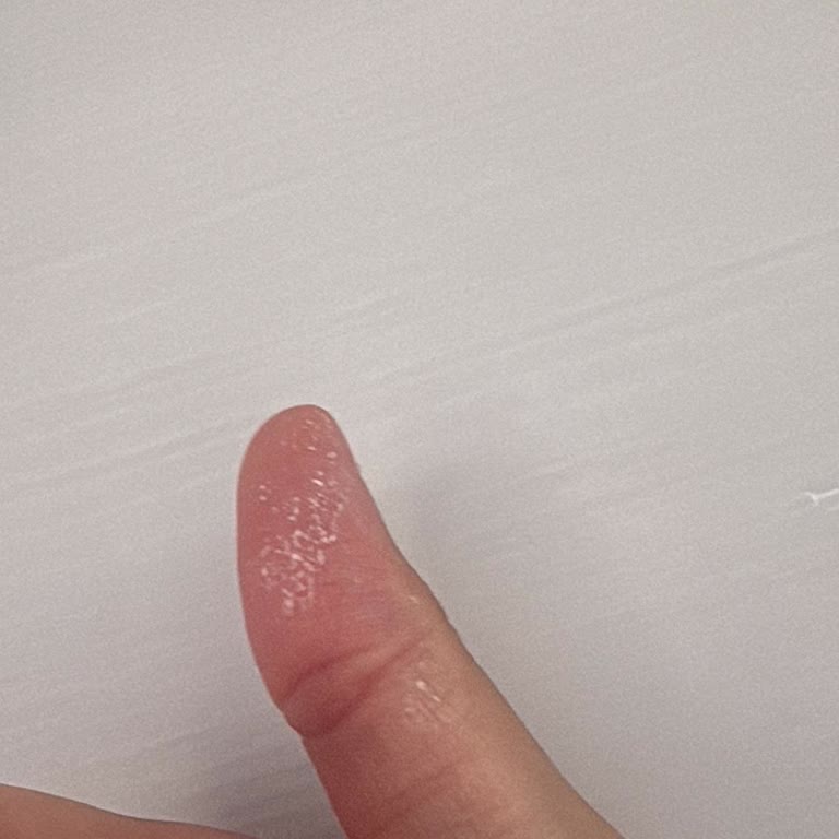 Vanish Kosla Sıvı Leke Çıkarıcı Ellerimde Yanma Ve Beyaz Leke Bıraktı Uyarı Yok