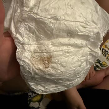 Bebek Bezlerinde Küf Benzeri Sorun Ve Sağlık Endişesi