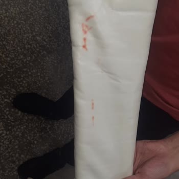 Arma Life Montta Leke Sorunu Ve Değişim Talebime Olumsuz Yanıt