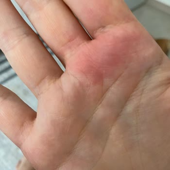 Altınkılıç Laktozsuz Kefir Açılırken Patladı, Güvenliğim Tehlikeye Girdi