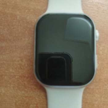 Vodafone Akıllı Saat Şarj Aleti İçin Destek Alamıyorum, Çözüm Bekliyorum