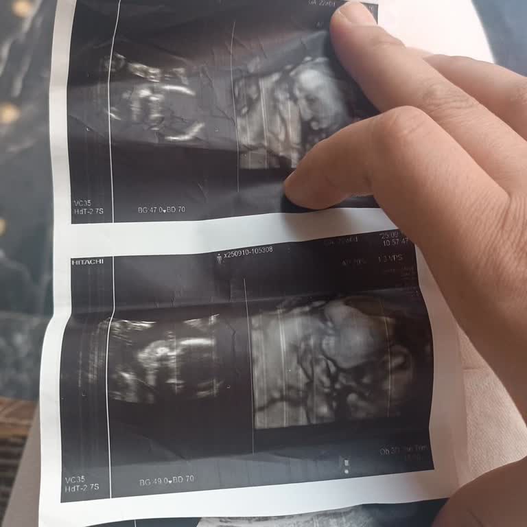 Gebelik İzleminde İlgisiz Personel Nedeniyle Mağduriyet Yaşadım