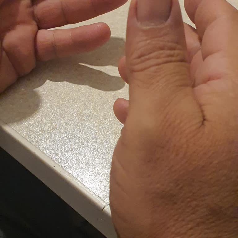 Ziraat Bankası Kart Teslimatında Adres Ve Bilgi Hatası Nedeniyle Mağduriyet