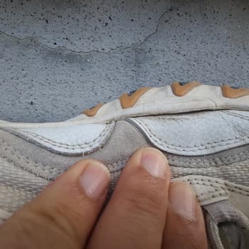 Skechers Ayakkabıda Erken Yıpranma Ve Mağazadan Dönüş Alamama Sorunu