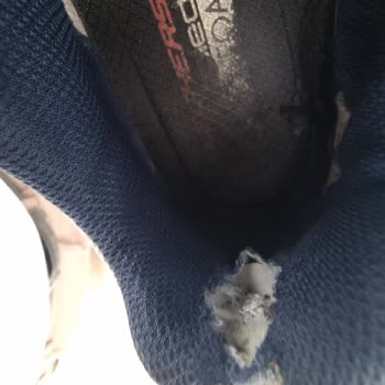 Skechers Ayakkabıda Erken Yıpranma Ve Mağazadan Dönüş Alamama Sorunu