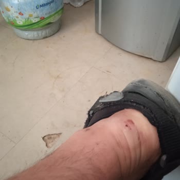 Kısa Sürede Yırtılan Ayakkabı Ve Yetersiz Müşteri Hizmeti Mağduriyeti