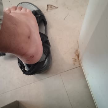 Kısa Sürede Yırtılan Ayakkabı Ve Yetersiz Müşteri Hizmeti Mağduriyeti