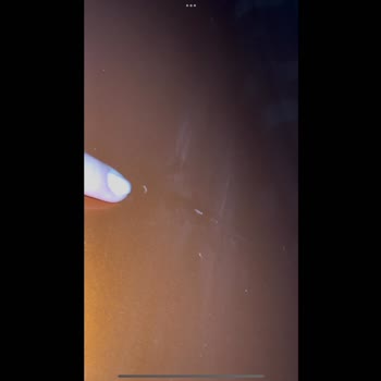 Servis Hatası Sonrası Aracımda Yeni Hasarlar Oluştu!