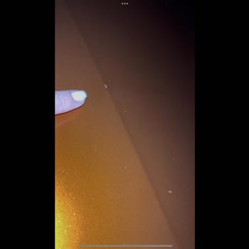 Servis Hatası Sonrası Aracımda Yeni Hasarlar Oluştu!