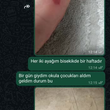 Ayakkabı Ayağımı Tahriş Etti, İade Talebim Reddedildi!