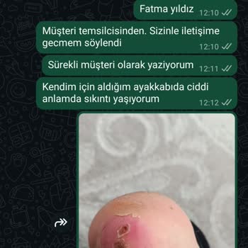 Ayakkabı Ayağımı Tahriş Etti, İade Talebim Reddedildi!