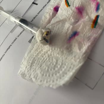 HP Smart Tank 515 Yazıcıda Sarı Renk Yazdırmama Ve Baskı Kafası Erişim Sorunu