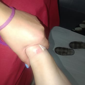 Kinetix Ayakkabı Ciddi Sağlık Sorunlarına Yol Açtı, FLO Ve Kinetix Sorumluluk Almadı