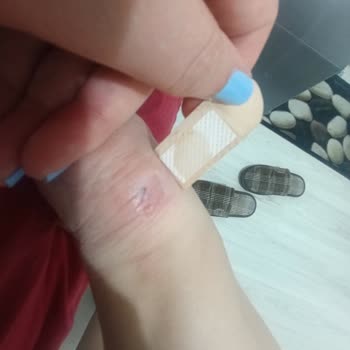 Kinetix Ayakkabı Ciddi Ayak Yaralanmalarına Sebep Oldu, Mağaza Ve Marka Çözüm Sunmadı