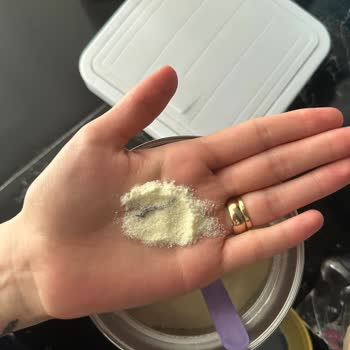 Mama Paketinden Yabancı Cisim Çıktı, Şirketten Dönüş Alınamadı