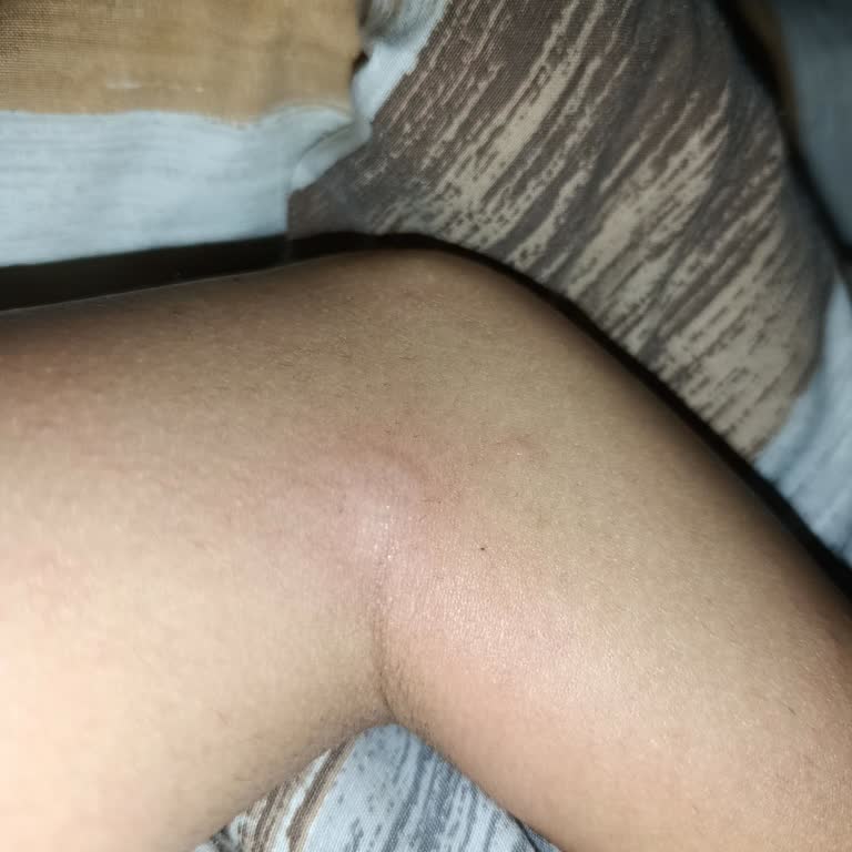 Agiss Tüy Dökücü Köpük Cildimde Kabarcık Oluşturdu, Son Kullanma Tarihi Belirsiz