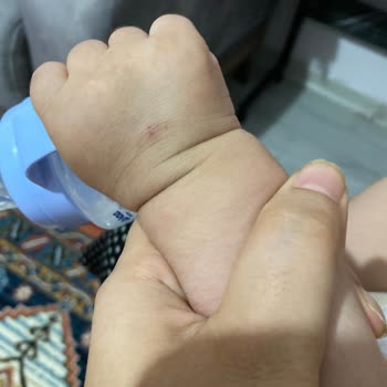 Murat Kölük Devlet Hastanesi Acil Serviste Yetersiz Müdahale Ve İlgisizlik Nedeniyle Mağduriyet