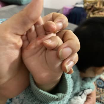 Murat Kölük Devlet Hastanesi Acil Serviste Yetersiz Müdahale Ve İlgisizlik Nedeniyle Mağduriyet