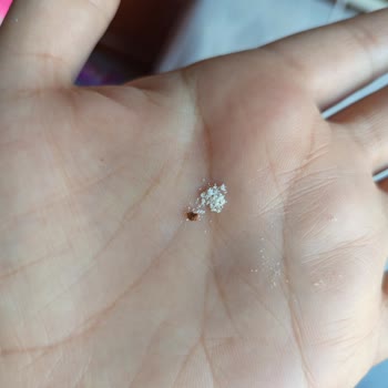 Bebek Mamasında Çıkan Yabancı Maddeler Nedeniyle Endişe Ve İade Talebi