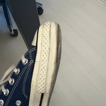 Converse Ayakkabım 6 Ayda Açıldı, Garanti Çözüm Sunmadı