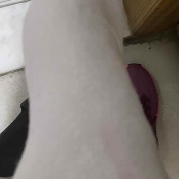 Ayakkabıdan Çoraplara Renk Geçişi Ve İade Talebim Reddedildi