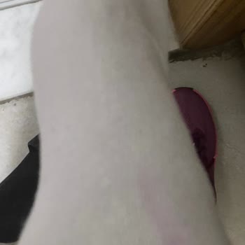 Ayakkabıdan Çoraplara Renk Geçişi Ve İade Talebim Reddedildi