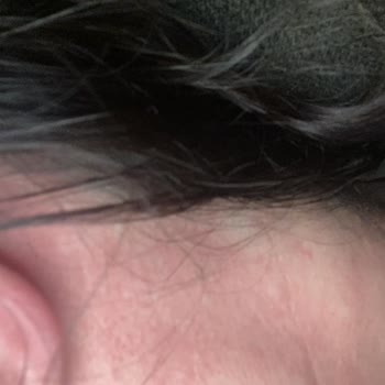 Mintax Yüzey Temizleyici Ciddi Alerjik Reaksiyona Sebep Oldu!