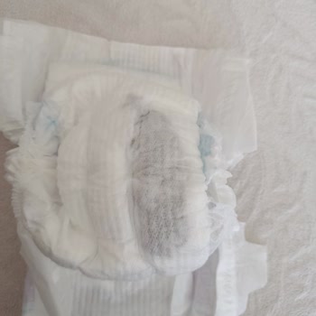 Bebek Bezinde Siyahlıklar Ve Hijyen Endişesi Yaşadım