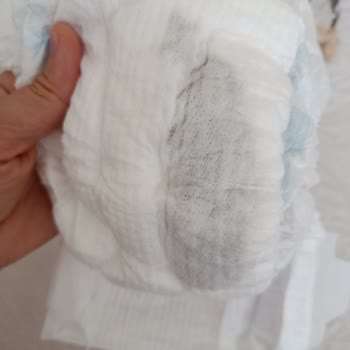 Bebek Bezinde Siyahlıklar Ve Hijyen Endişesi Yaşadım