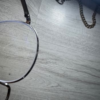 Sipariş Edilen Gözlük Camları Hatalı Ve Çerçevem Ciddi Şekilde Zarar Gördü