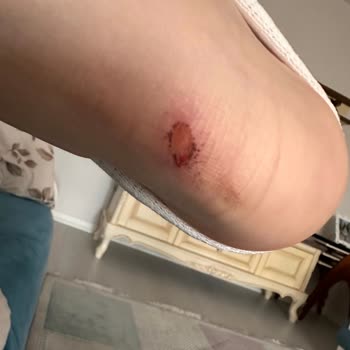 Aldığım Ayakkabı Ayağımı Yaraladı, Müşteri Hizmetlerinden Yanıt Alamıyorum