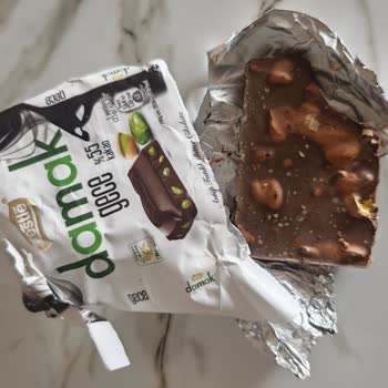 Bozuk Damak Çikolata Nedeniyle Çocuğumun Sağlığı Tehlikeye Girdi