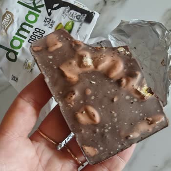 Bozuk Damak Çikolata Nedeniyle Çocuğumun Sağlığı Tehlikeye Girdi