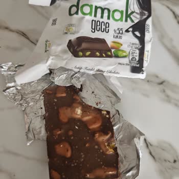 Bozuk Damak Çikolata Nedeniyle Çocuğumun Sağlığı Tehlikeye Girdi