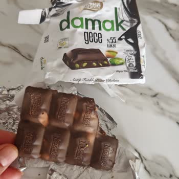 Bozuk Damak Çikolata Nedeniyle Çocuğumun Sağlığı Tehlikeye Girdi