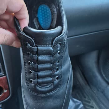 Yeni Alınan Ayakkabıda Geçmeyen Kokuya Rağmen Değişim Reddedildi