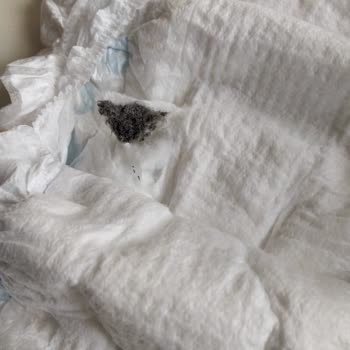 Molfix Bebek Bezinde Yabancı Maddeyle Karşılaşmak Endişe Yarattı