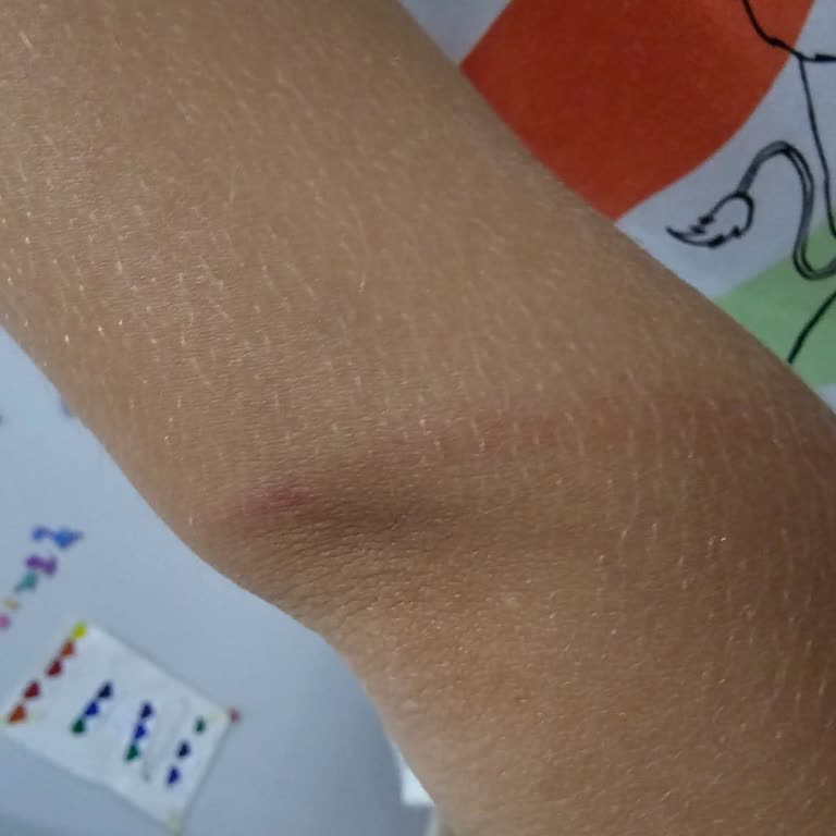 Oyun Alanında Çocuğuma Uygunsuz Müdahale Ve İşletmeden Olumsuz Tavır