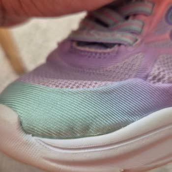 Yıkanabilir Skechers Çocuk Ayakkabısında Deformasyon Ve İade Sorunu