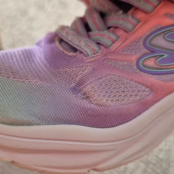 Yıkanabilir Skechers Çocuk Ayakkabısında Deformasyon Ve İade Sorunu