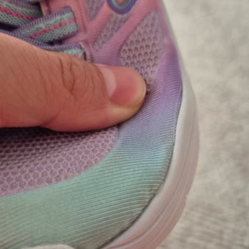 Yıkanabilir Skechers Çocuk Ayakkabısında Deformasyon Ve İade Sorunu