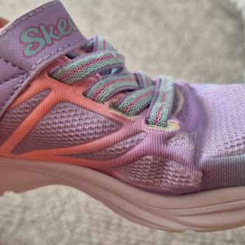 Yıkanabilir Skechers Çocuk Ayakkabısında Deformasyon Ve İade Sorunu