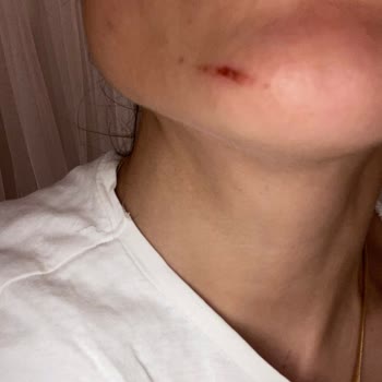 Mutfak Dolabının Üzerime Düşmesi Sonucu Mağduriyet Ve İlgisizlik