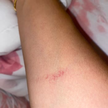 Mutfak Dolabının Üzerime Düşmesi Sonucu Mağduriyet Ve İlgisizlik