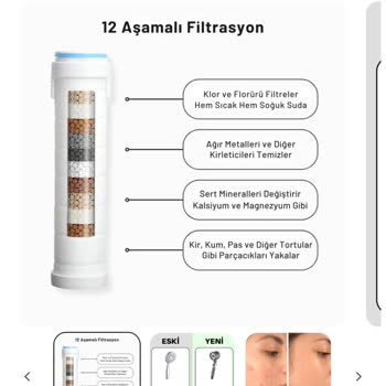 Hydropulse Duş Başlığında Eksik Filtre Ve Yetersiz Müşteri Desteği Mağduriyeti