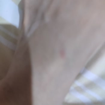 İlk Kullanımda Ayağımı Yaralayan Terlik Ve Müşteri Hizmetlerine Ulaşılamaması