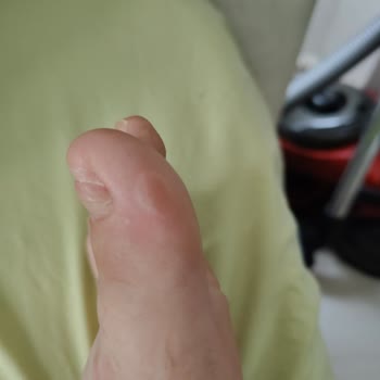 Beymen Michael Kors Yağmur Botunda Konfor ve Sağlık Sorunu Yaşadım